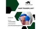 Pioneer Hair Transplant: Hair Transplant Cost in Bangalore Explained