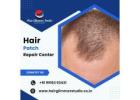 Hair Glimmer Studio-Hair Patch Repair center in Bangalore