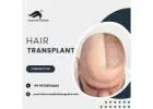 The Ultimate Guide to Hair Transplant in Bangalore: Pioneer's Expertise Unveiled