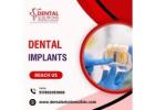 Cost of Dental Implants in Bangalore-Dental Solutions