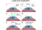 LASIK Eye Surgery In Delhi NCR