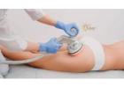 How Cellulite Treatment in San Diego Can Help You